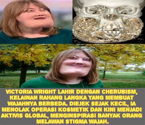 game lagu cari case langka bagi yang butuh gems banyak nomor Telkomsel utama image 3